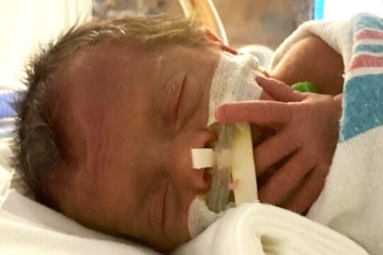 Retinopathy of Prematurity (ROP) and your child’s lifelong vision health Retinopathy of Prematurity (ROP) and your child’s lifelong vision health